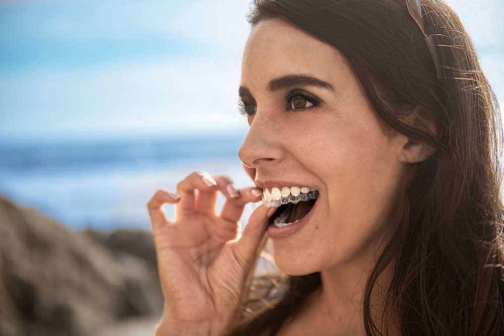 invisalign - durchsichtige zahnschiene